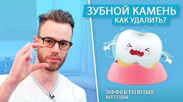 Как удалить зубной камень. Можно ли убрать в домашних условиях?