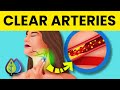 6 best remedies to clear out your arteries