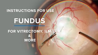 BIONIKO - FUNDUS - INSTRUCTIONS FOR USE - ILM and VITRECTOMY