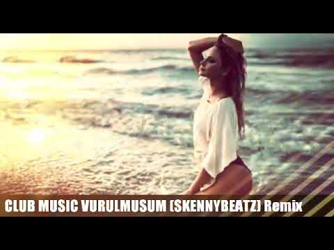 Vurulmuşum- Skenny Beatz Remix