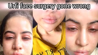 Urfi javeed share pics of her face swollen from allergies🔥 urfi javeed share pic in red swollen face
