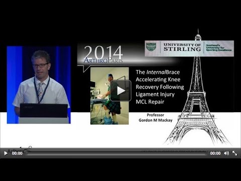 orthopedic banawe The InternalBrace™ Accelerating Knee Recovery Following Ligament Injury MCL