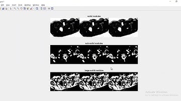 Pulmonary Nodule Detection in CT Images Project | Pulmonary Nodule Detection in CT Images Thesis