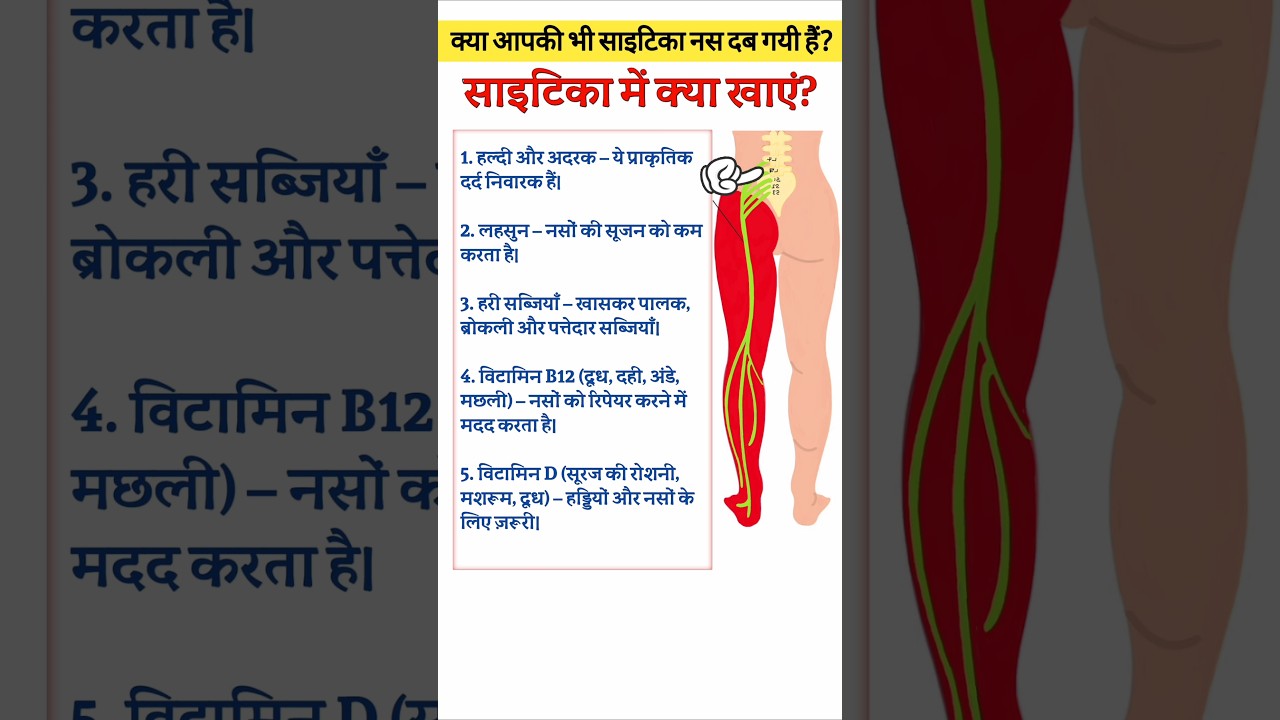 sciatica ka dard 🔥😱😭 