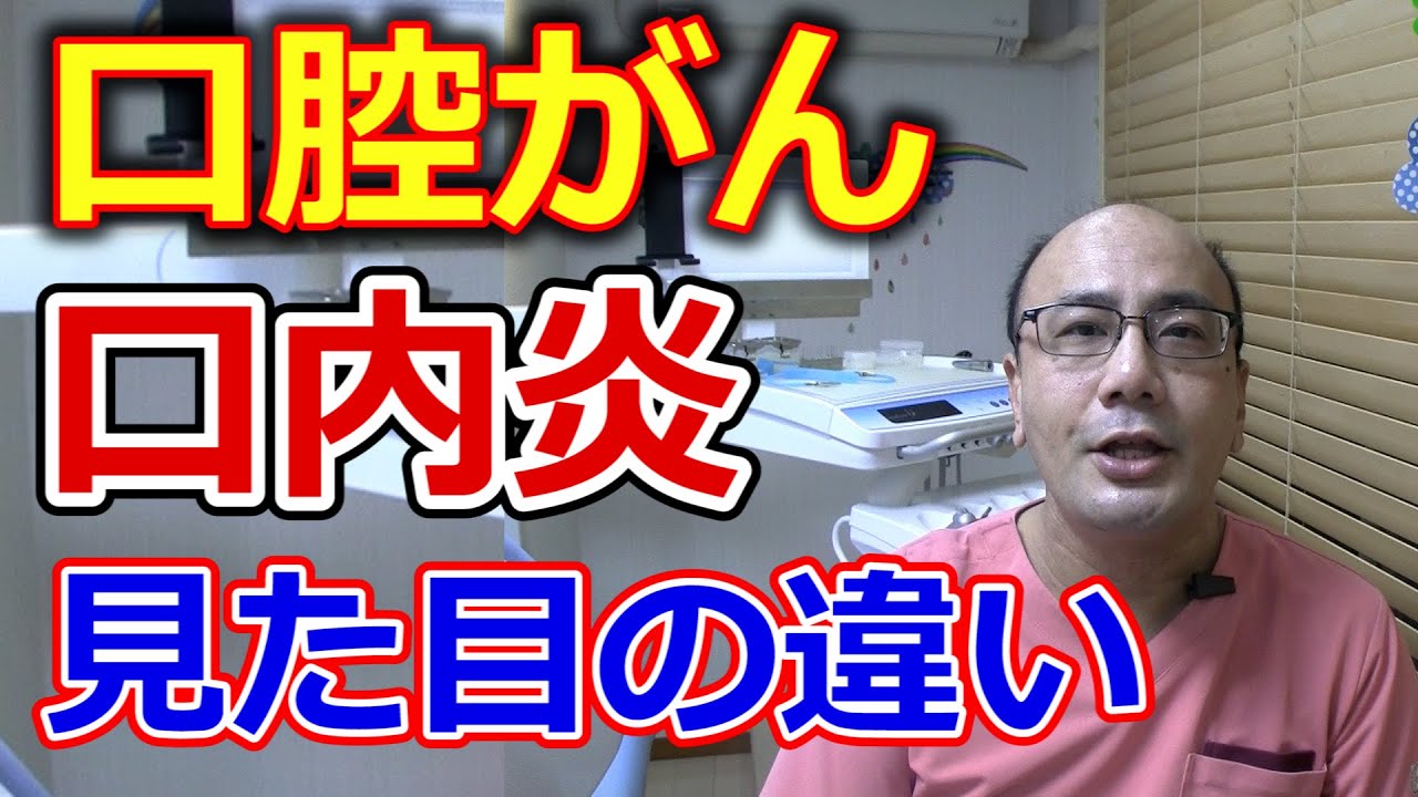 口腔がんと口内炎の見た目の違いとは?【千葉市中央区の歯医者】 - YouTube