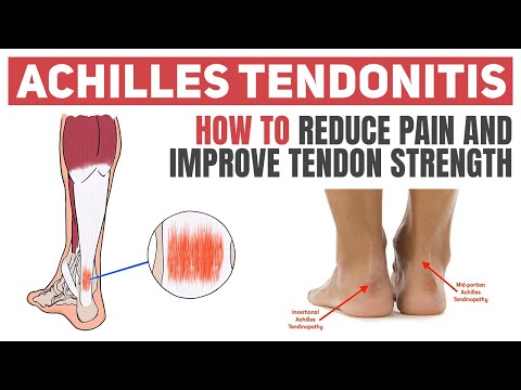 Achilles Tendonitis - Exercises to Heal and Strengthen Your Tendon ...