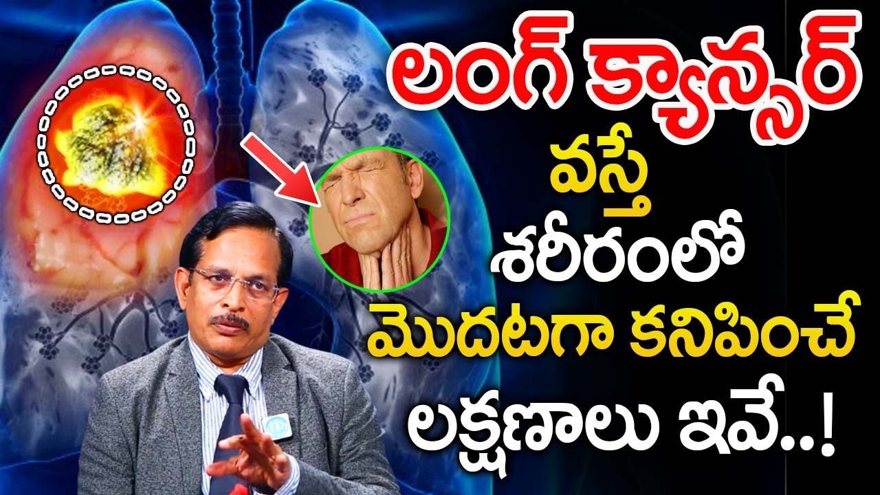 లంగ్ క్యాన్సర్ వస్తే కనిపించే మొదటి లక్షణం..| Lung Cancer Symptoms | Dr.D Ram Mohan Reddy |@iDream