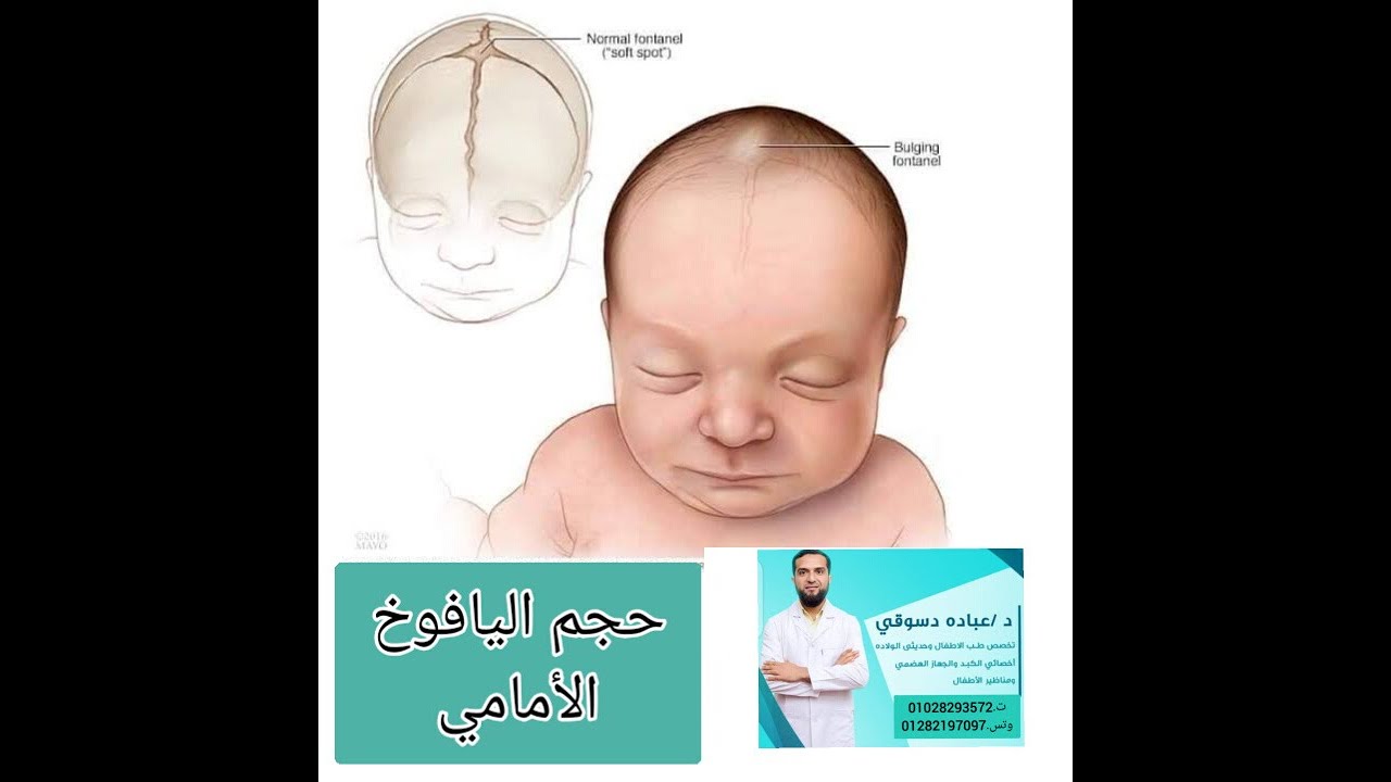 حجم اليافوخ أو النافوخ الأمامي وامتي يقفل.