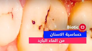 حساسية الأسنان من الماء البارد