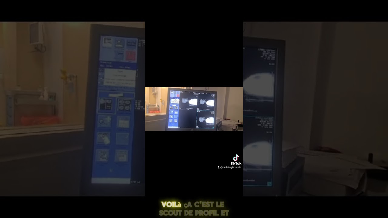 technique de l'angioscanner des TSA.