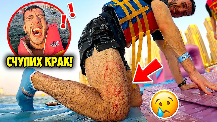 ДАНИ СИ СЧУПИ КРАКА | СТАНА ИНЦИДЕНТ!