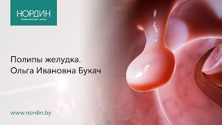 Полипы желудка, врач Ольга Букач