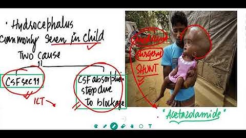 Neural control and coordination for NEET,AIIMS,CLASS11TH || NERVOUS SYSTEM  for AIIMS , NEET