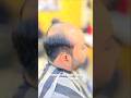 Permanent Hair Patch +919926978311 #praveenhairwig #hairextension #tranding #indore #wig #reel #hair
