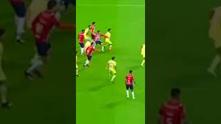 Las Guilotas Del América