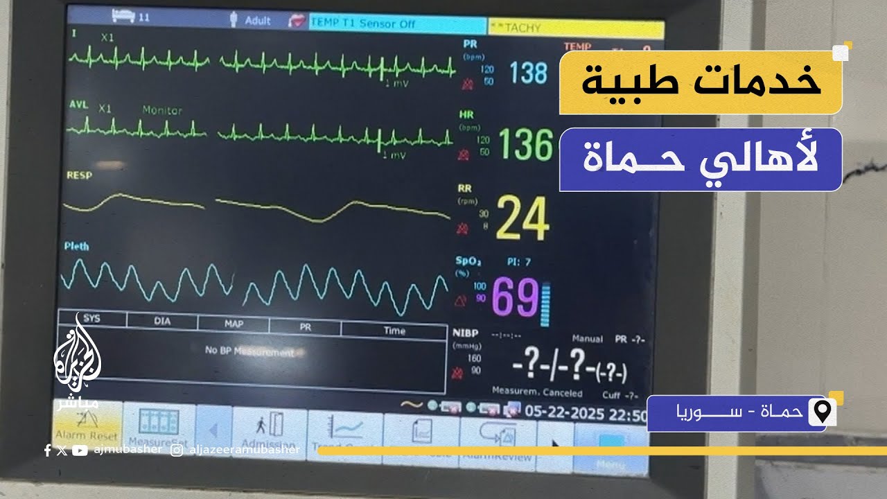بأحدث الأجهزة.. افتتاح قسم العناية المشددة في مشفى حماة