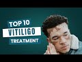 Vitiligo | Symptoms | Causes | Where it appears | Latest treatments | Phototherapy