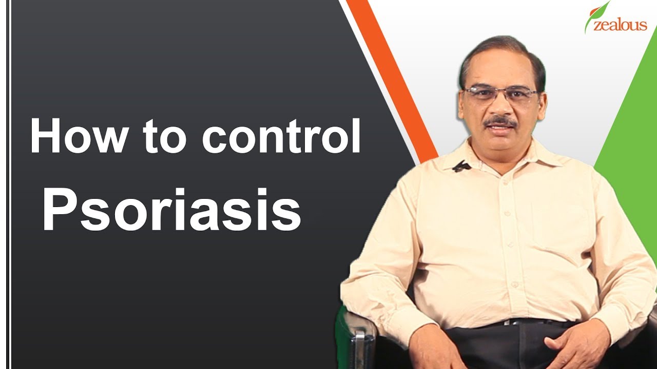 How to Control Psoriasis | Herbal Treatment for Psoriasis | Zealous Health