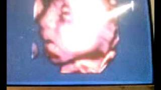 La Ecografia 4D De Nuestra Bebezota Mariana...