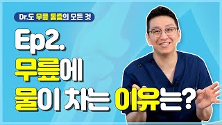 [Dr.도] 무릎에 물이 차는 이유는?