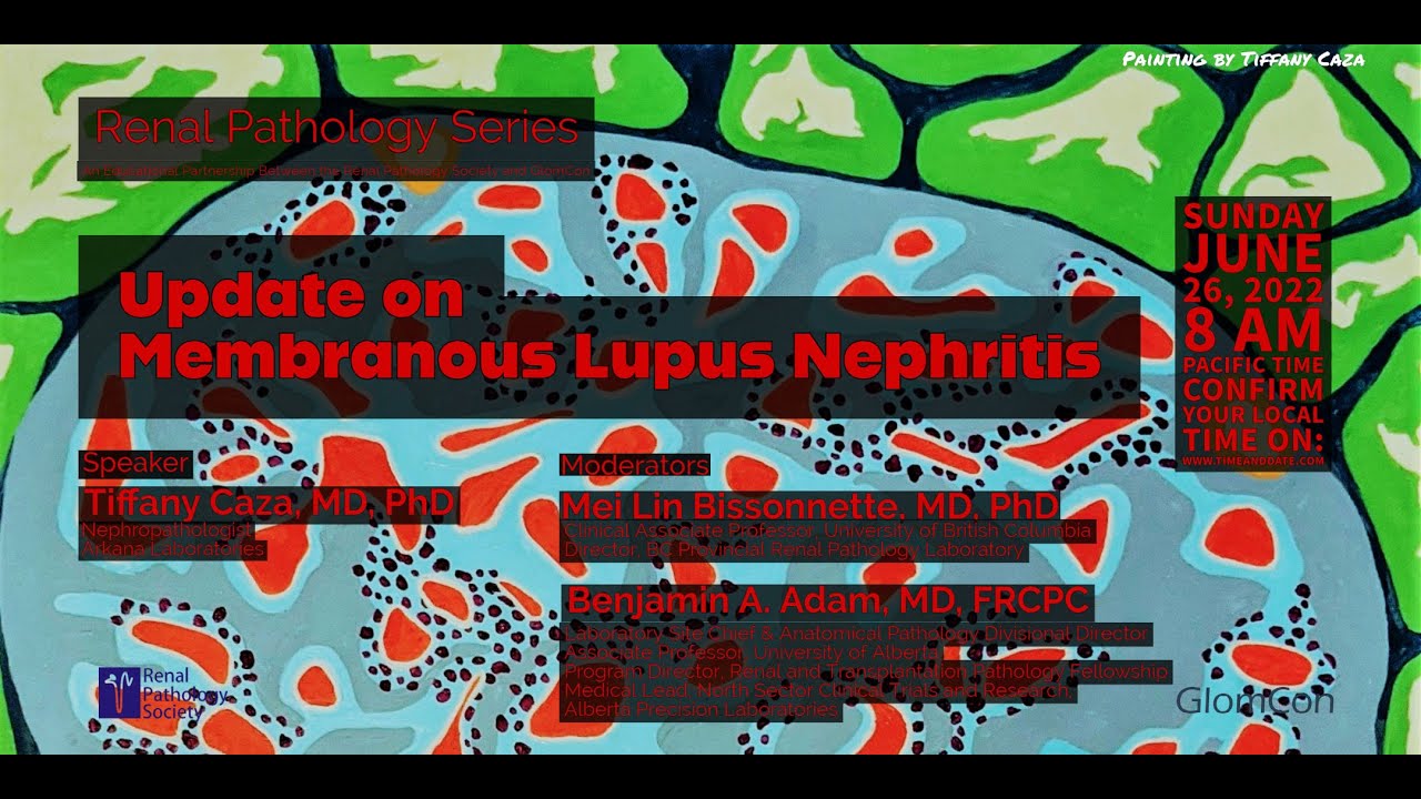 Update on Membranous Lupus Nephritis