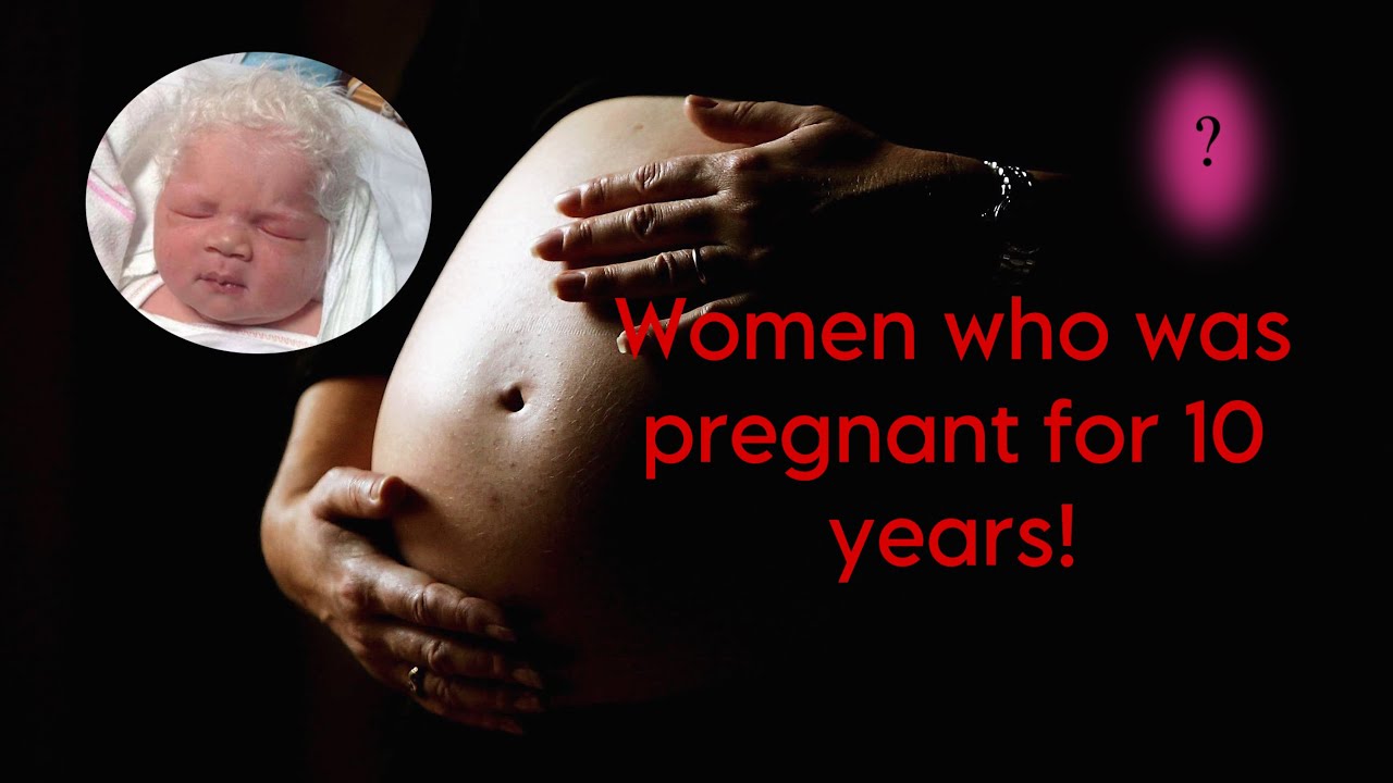 The baby came out like this? YouTube