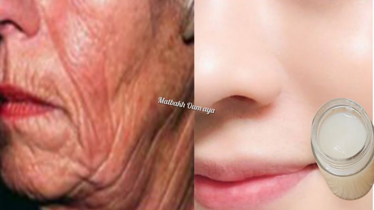 اقسم بالله زيت الزيتون على النشا ! يزيل التجاعيد فورًا ويجعلك أصغر بـ 20 سنة لبشرة بيضاء بدون تجاعيد