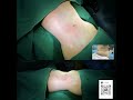 #mtf #mff #ts #ffs #Transgender MTF身材改造|腰腹黄金微雕|无修图对比 #duet #pregnant #massage