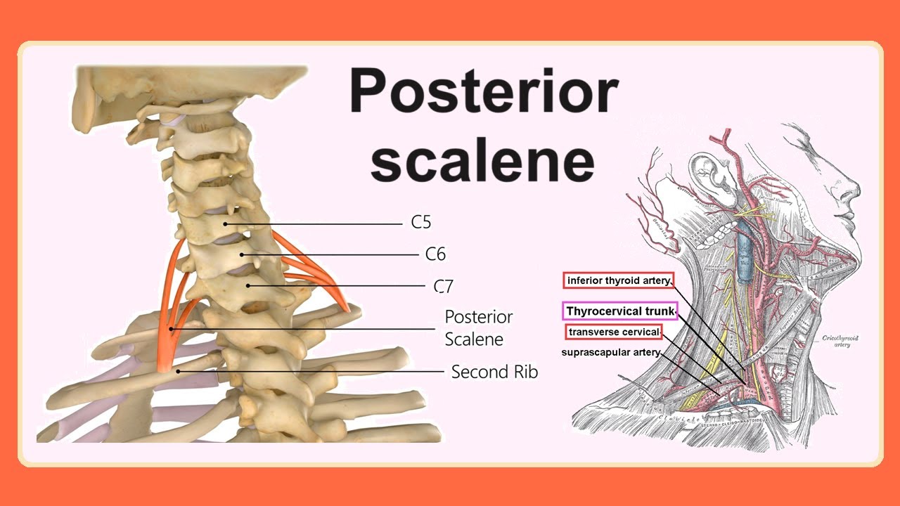 Posterior Scalene YouTube posterior-scalene-youtube