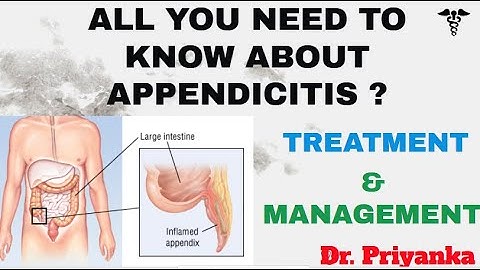 APPENDICITIS |ALL YOU NEED TO KNOW ABOUT APPENDICITIS |MANAGEMENT|SIGN & SYMPTOMS~Dr. Priyanka saini