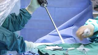 Bariatric surgeon in Orange Park explains hernia repair