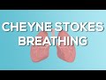 Cheyne stokes breathing  causes demonstration treatment