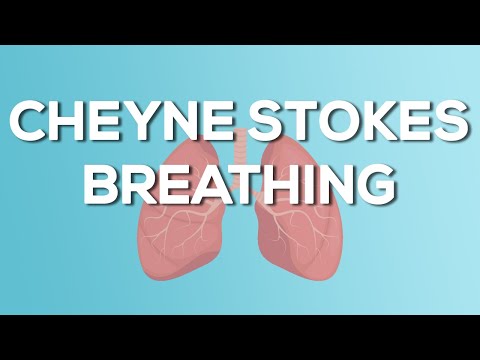 Cheyne Stokes Breathing - Causes, Demonstration, Treatment
