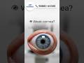 👁️ Weak cornea? Glasses don’t have to be forever!With advance #clearvision #smiledesigndental