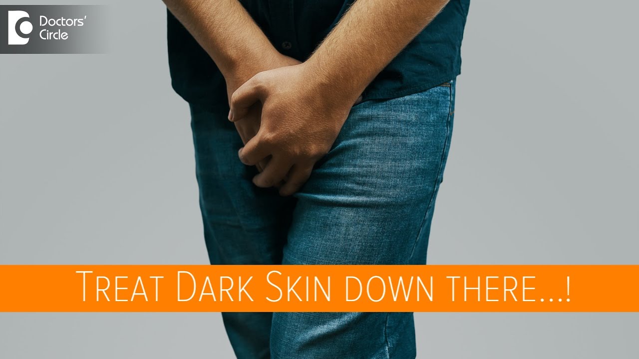 Lighten The Dark Skin Down There Due To Darkness After Fungal Infection-Dr.Nischal K|Doctors' Circle