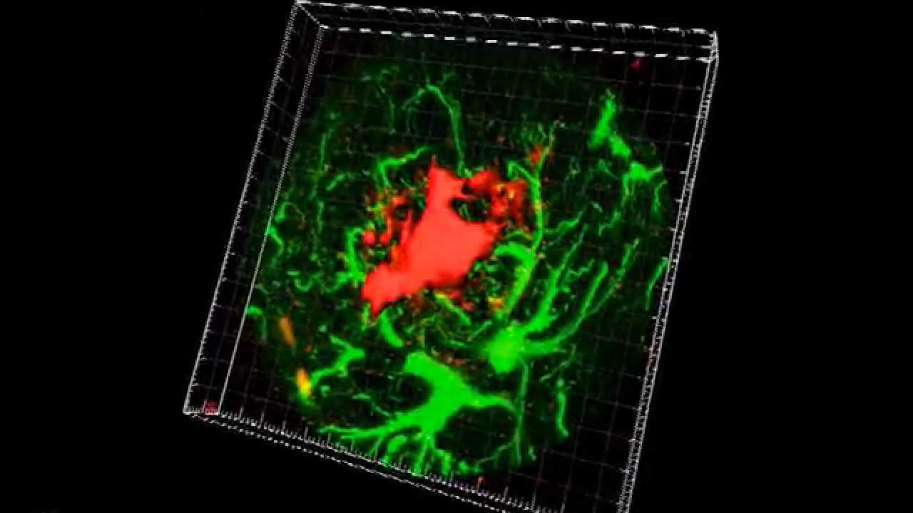 The Brain Research Group's Progress on Alzheimer's - The Brain Research Group's Progress on Alzheimer's