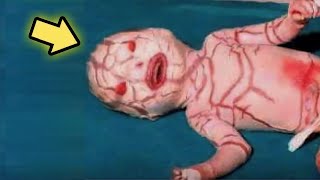 Bebê nasce com condição rara e choca pais que decidem...