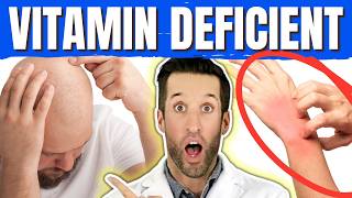 10 Warning Signs & Vitamin Deficiencies You Can't Ignore
