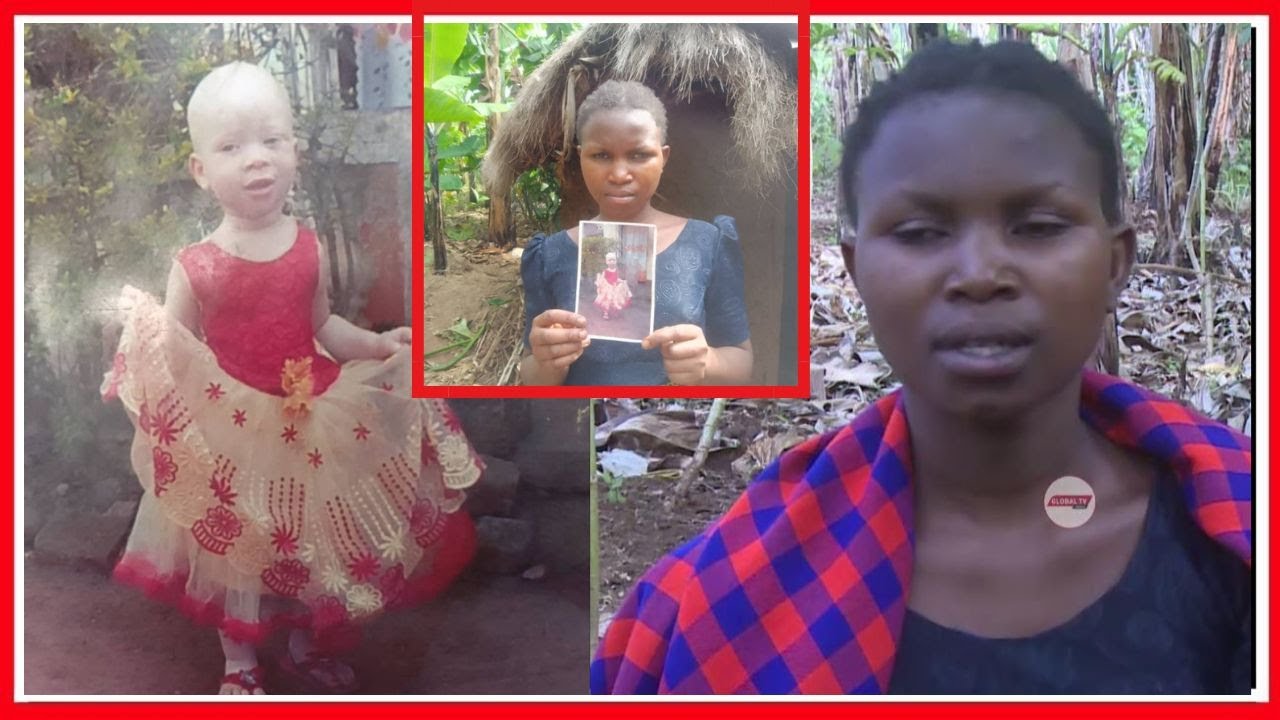 MAMA ASIMULIA MTOTO WAKE MWENYE UALBINO ALIVYOIBWA MULEBA na WATU WASIOJULIKANA......