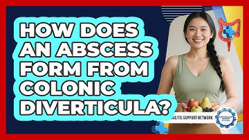 How Does An Abscess Form From Colonic Diverticula? - Diverticulitis Support Network