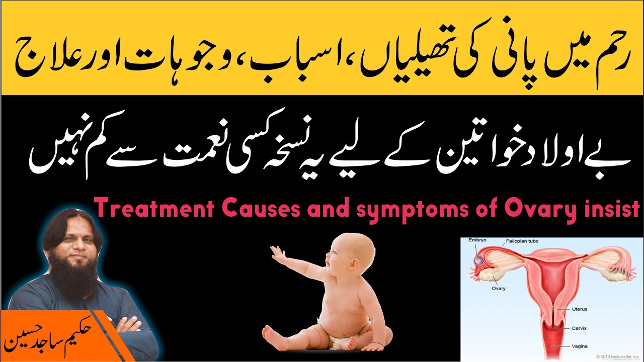 Ovarian Cysts Causes, Symptoms & Treatment Reham me Pani ki Thailian ka ilaj BY HAKEEM SAJID