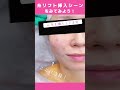 【糸リフト】引き上げるってこういうこと!#湘南美容 #shorts