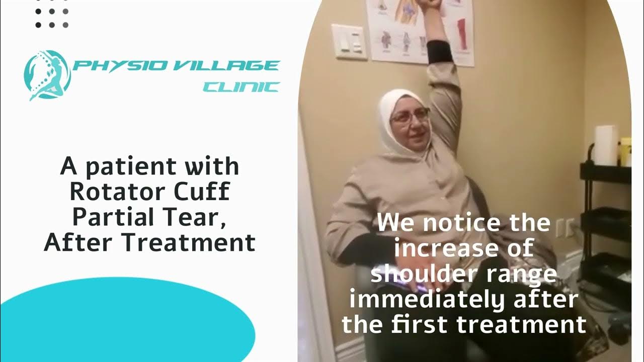 Rotator Cuff Pains Fixed in the First Visit YouTube