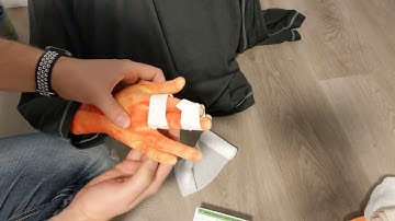 Splinting Unstable Finger Injuries