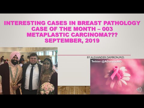 Interesting Cases in Breast Pathology (003) - Metaplastic Carcinoma September, 2019