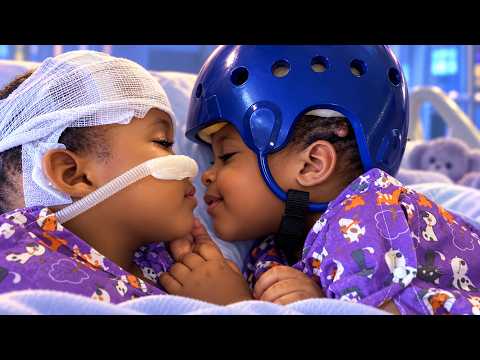 After a 24-hour surgery, these conjoined twins have been separated