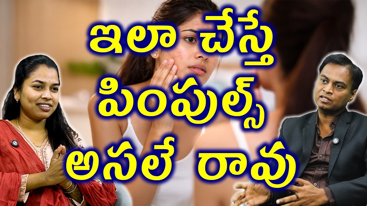ఇలా చేస్తే పింపుల్స్ అసలే రావు How to Stop Pimples Before They Start | Homeopathy Treatment Medicine