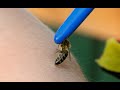 Pro здоров’я: наскільки корисна апітерапія – лікування укусами бджіл?