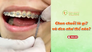 Thun chuỗi là gì? Đeo thun chuỗi như thế nào?