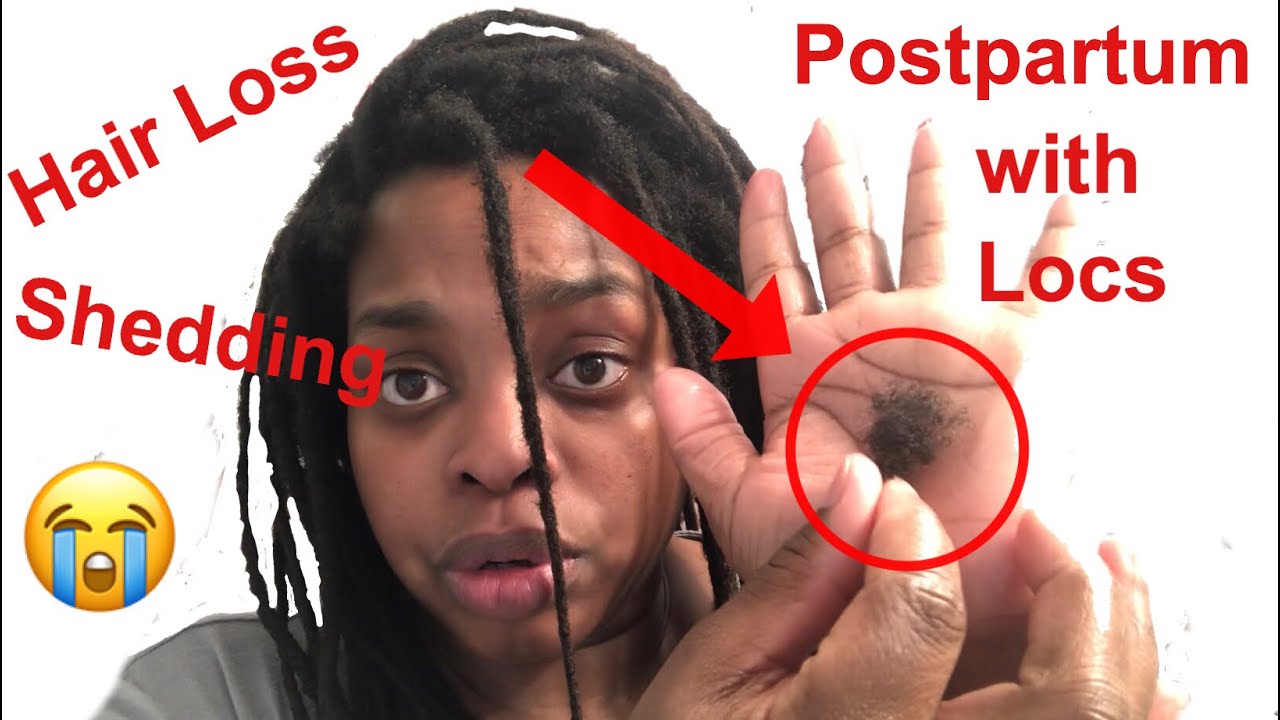Hair Loss With Locs YouTube